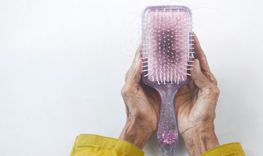 Does Radiotherapy Cause Hair Loss?